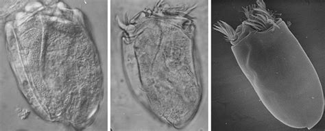  Burrowing Ciliate: A Tiny Wanderer Unearthing Secrets Beneath the Microscope!